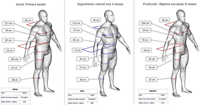 El IBV desarrolla indicadores de salud basados en antropometría digital y formas 3D del cuerpo humano