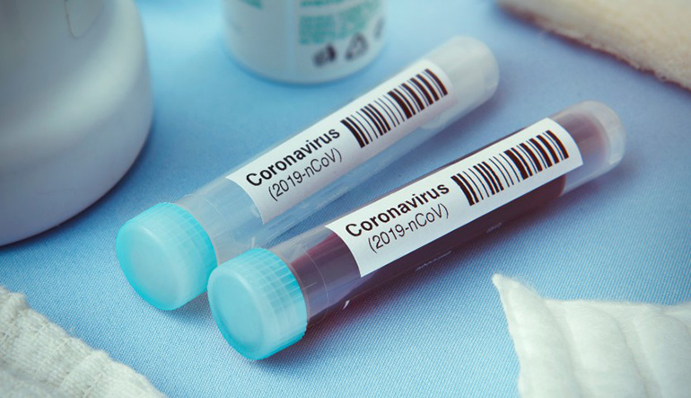 Ya hay 20 vacunas en desarrollo contra el coronavirus, señalan desde Farmaindustria