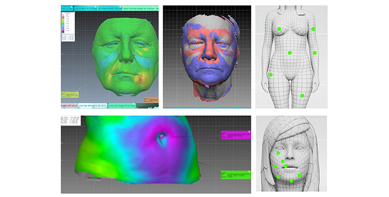 Sensor de escaneo tridimensional para la evaluación topográfica de la piel