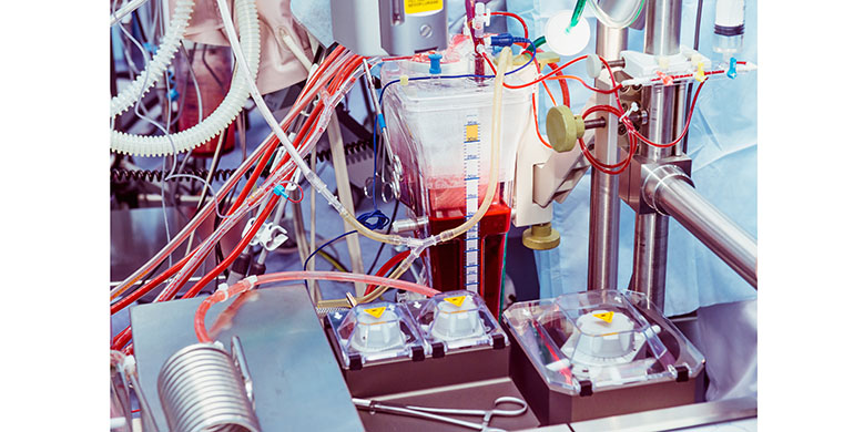 Grifols estudia sacar a bolsa su división Biopharma en Estados Unidos