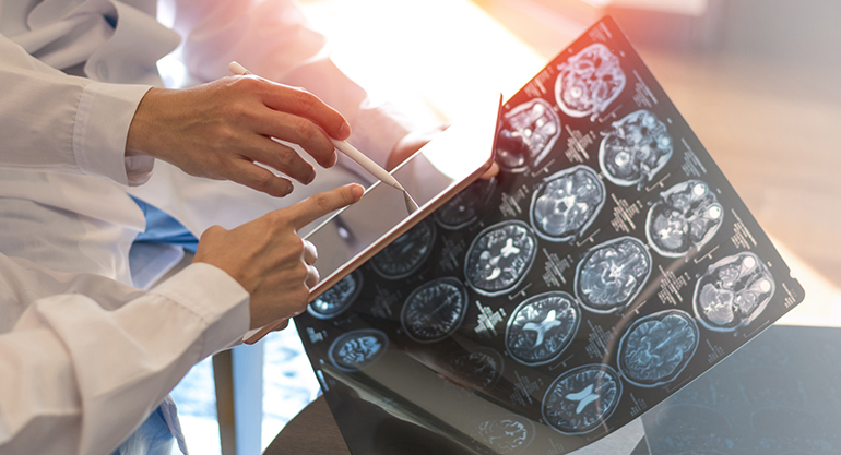 Boehringer Ingelheim y Tessellate Bio se unen para desarrollar tratamientos dirigidos innovadores para personas con cánceres difíciles de tratar