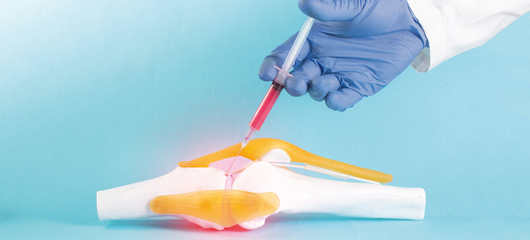 Hidrogeles inyectables reforzados con nanocompuestos de calcio