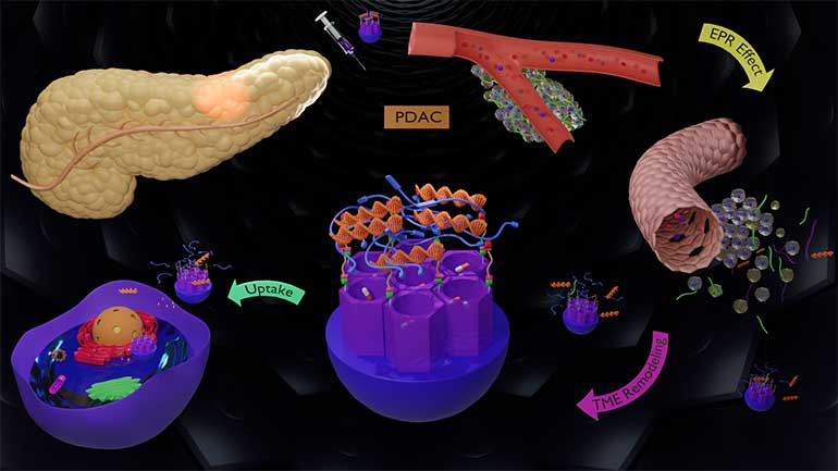 IQS lidera un proyecto de investigación para el tratamiento del cáncer de páncreas