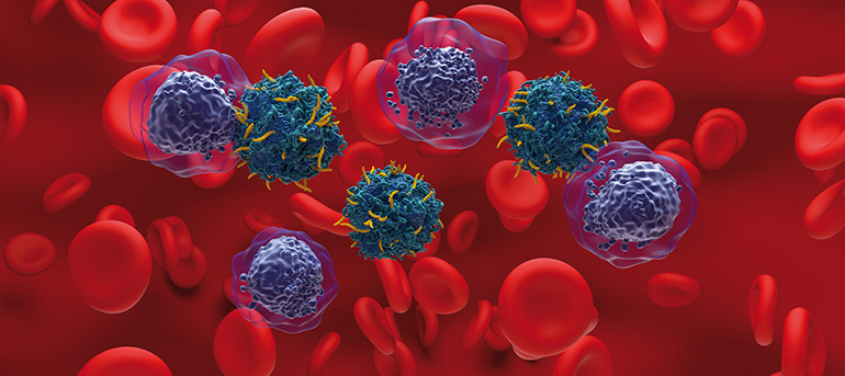 Terapias CAR-T con receptores quiméricos de antígenos