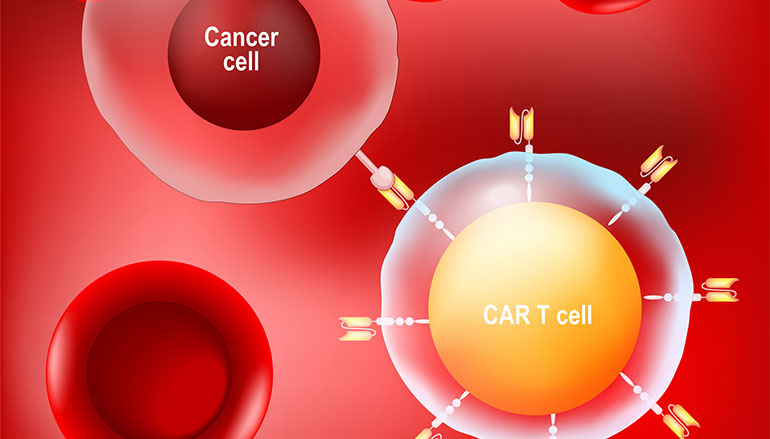 Autorizado un ensayo clínico único en el mundo con tecnología CAR-T para pacientes con un subtipo de Leucemia de células T 
