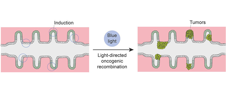 mini‑cólones para investigar el cáncer de colon con precisión inédita