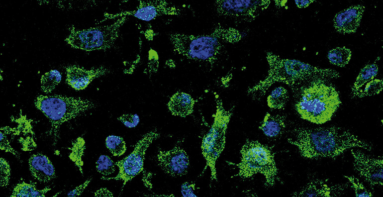 Molefy Pharma obtiene autorización de la AEMPS para iniciar la Fase I de su terapia innovadora para tratar la ELA