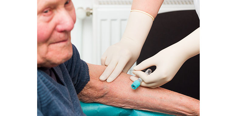-prueba-elecsys-ptau217-roche-obtiene-marcado-ce-diagnosticar-alzheimer