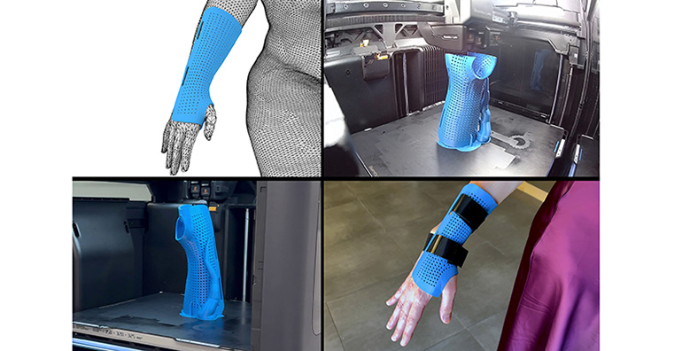impresion-3d-avanzar-en-productos-sanitarios-personalizados-sostenibles-impulsada-ibv-aidimme-aiju