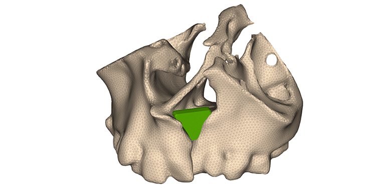 Un implante bioinspirado liderado por IQS abre nuevas vías para la regeneración ósea infantil