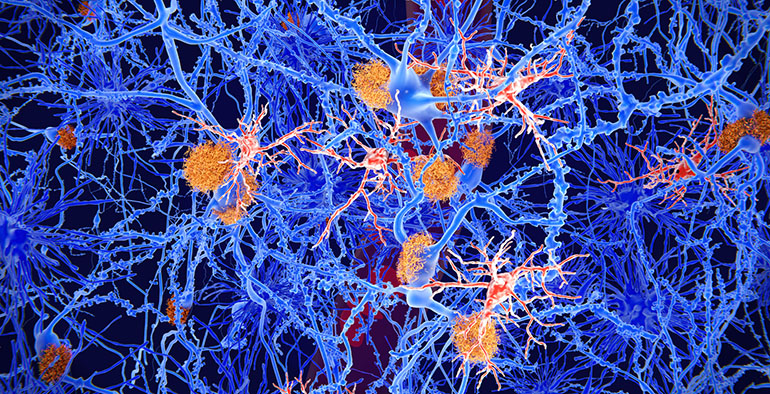 Un proyecto de IQS sobre metabolismo cerebral obtiene una beca de la Fundación Pasqual Maragall