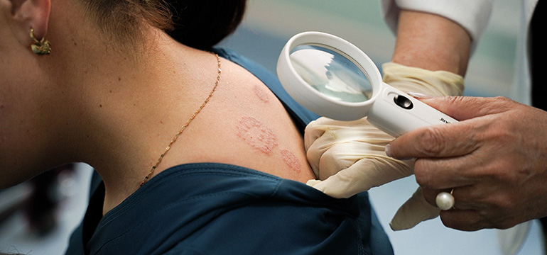 Un estudio global alerta de graves desigualdades en el acceso a la dermatología y refuerza la necesidad de políticas sanitarias basadas en datos