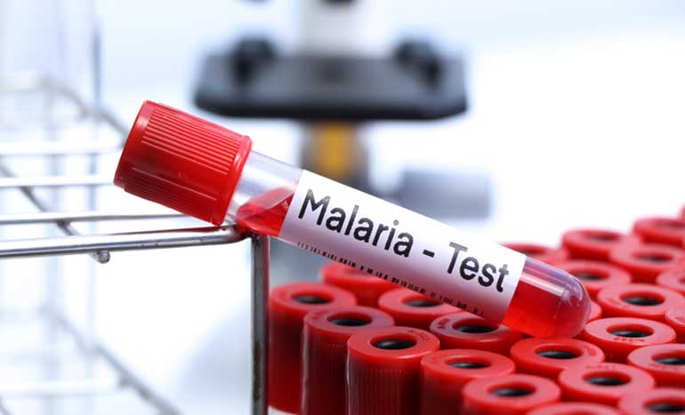 Investigadores españoles identifican una barrera defensiva para luchar contra la malaria