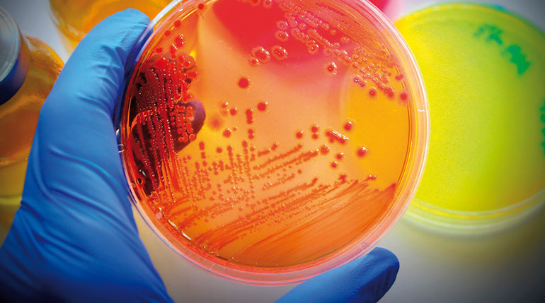 MSD recibe la distinción “Grandes Avances en la Microbiología”