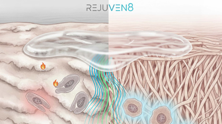 Bioadhesivos inteligentes para curar sin cicatrices
